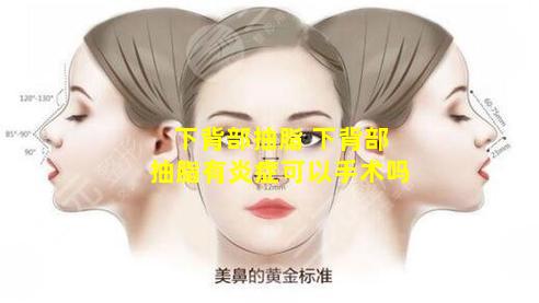 下背部抽脂 下背部抽脂有炎症可以手术吗